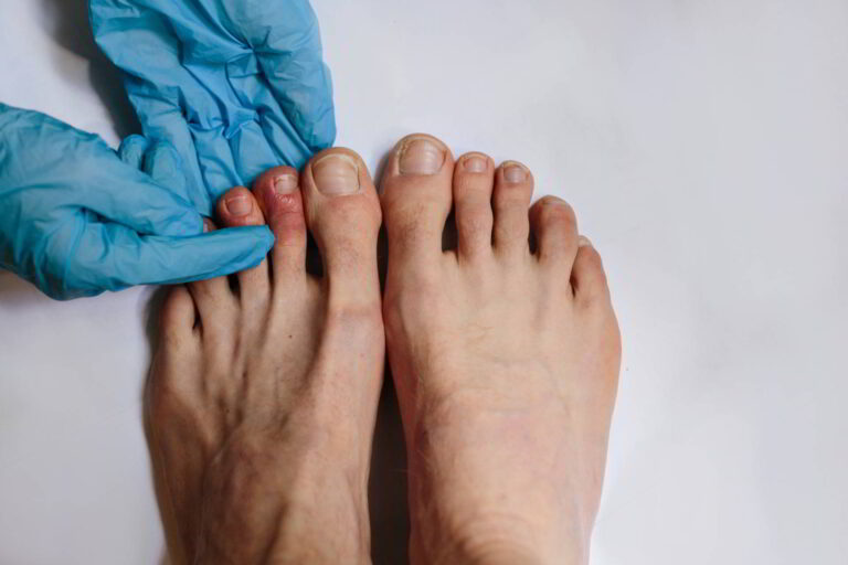 Doctor checking foot for athlete's foot